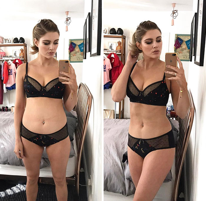 before-after-posture-instagram-body-photos-34.jpg