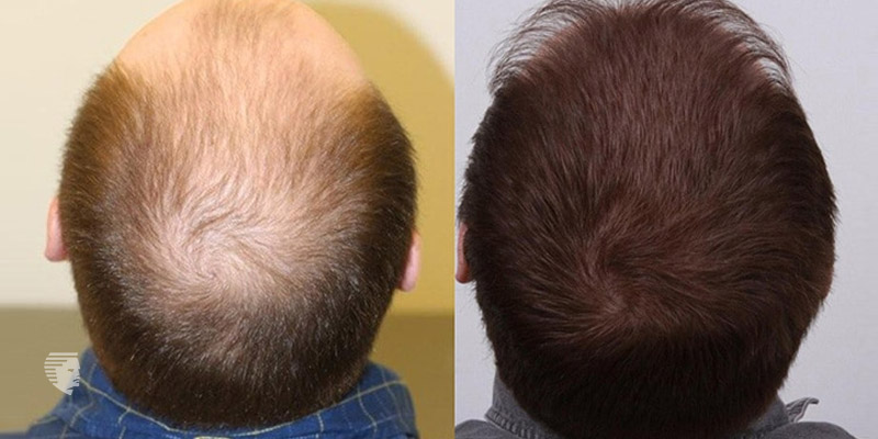 BeVital Advanced Hair Growth 1.jpg