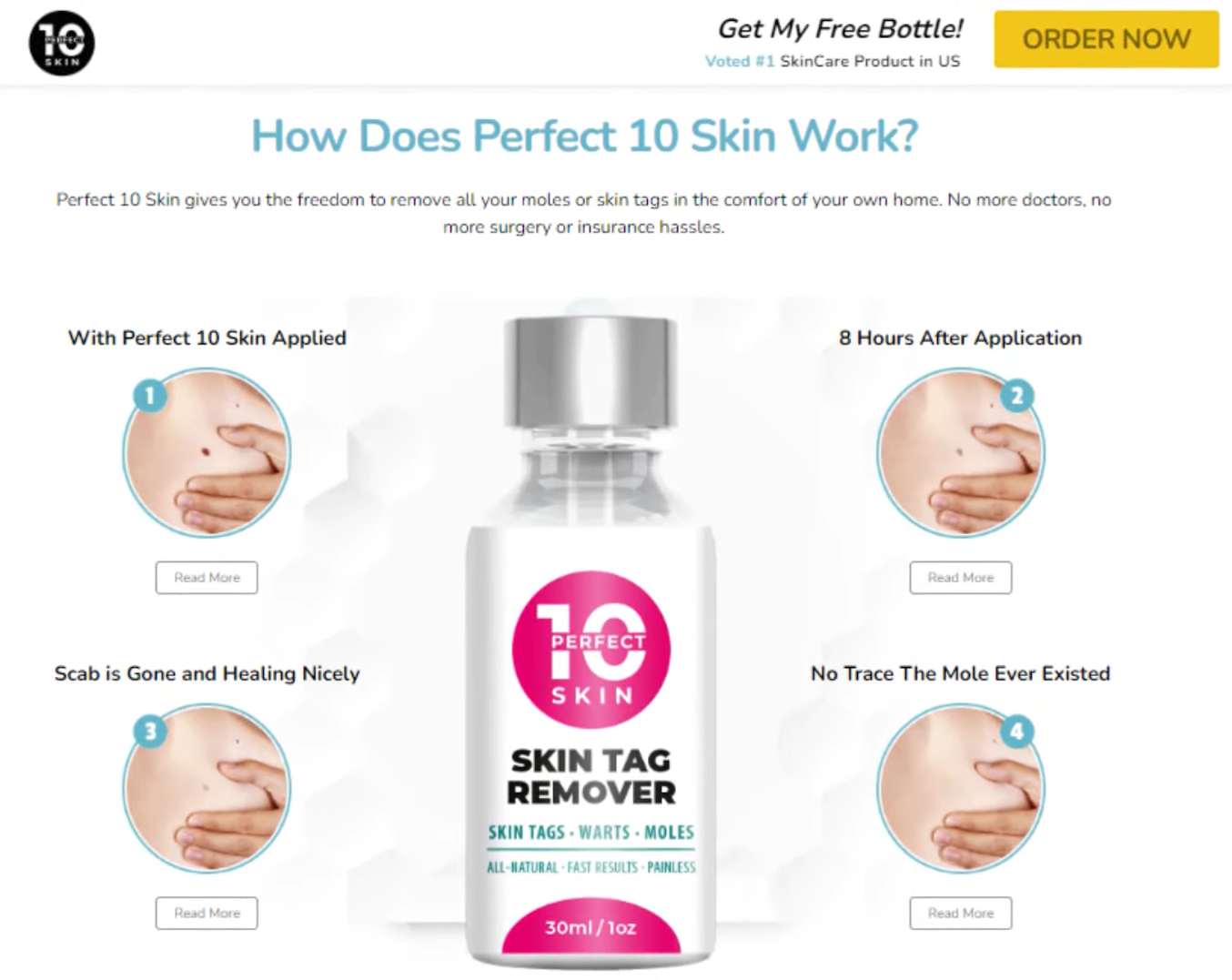perfect 10 skin tag remover Reviews.png