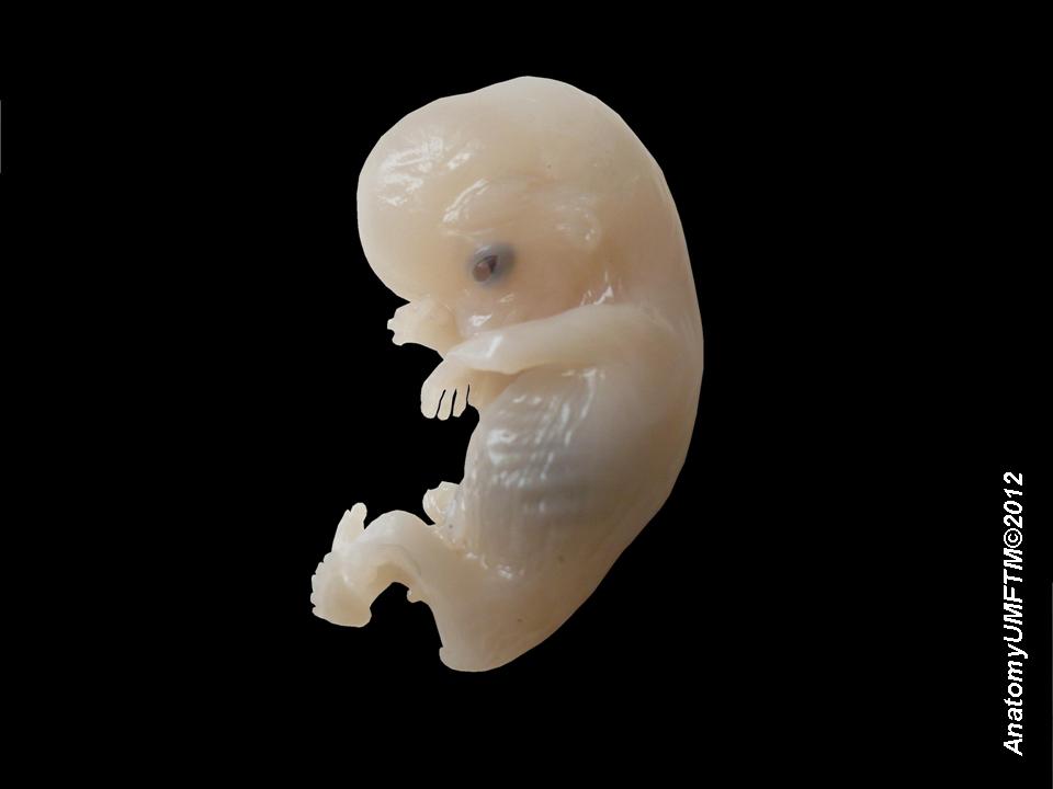 Human_embryo.jpg