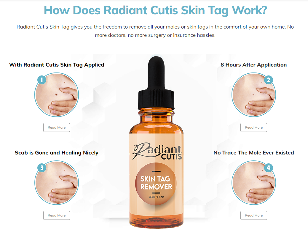 Radiant Cutis Skin Tag Remover Benefits.png