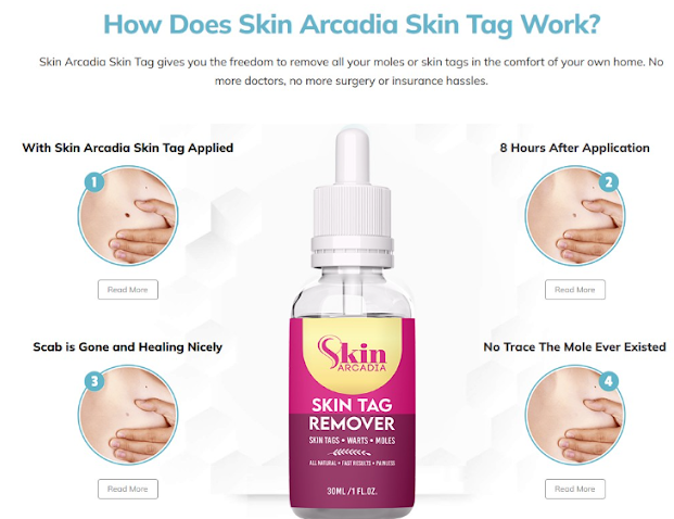 Skin Arcadia Skin Tag Removerad.png