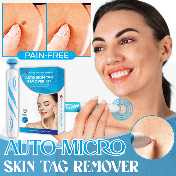 Superdrug Skin Tag Remover