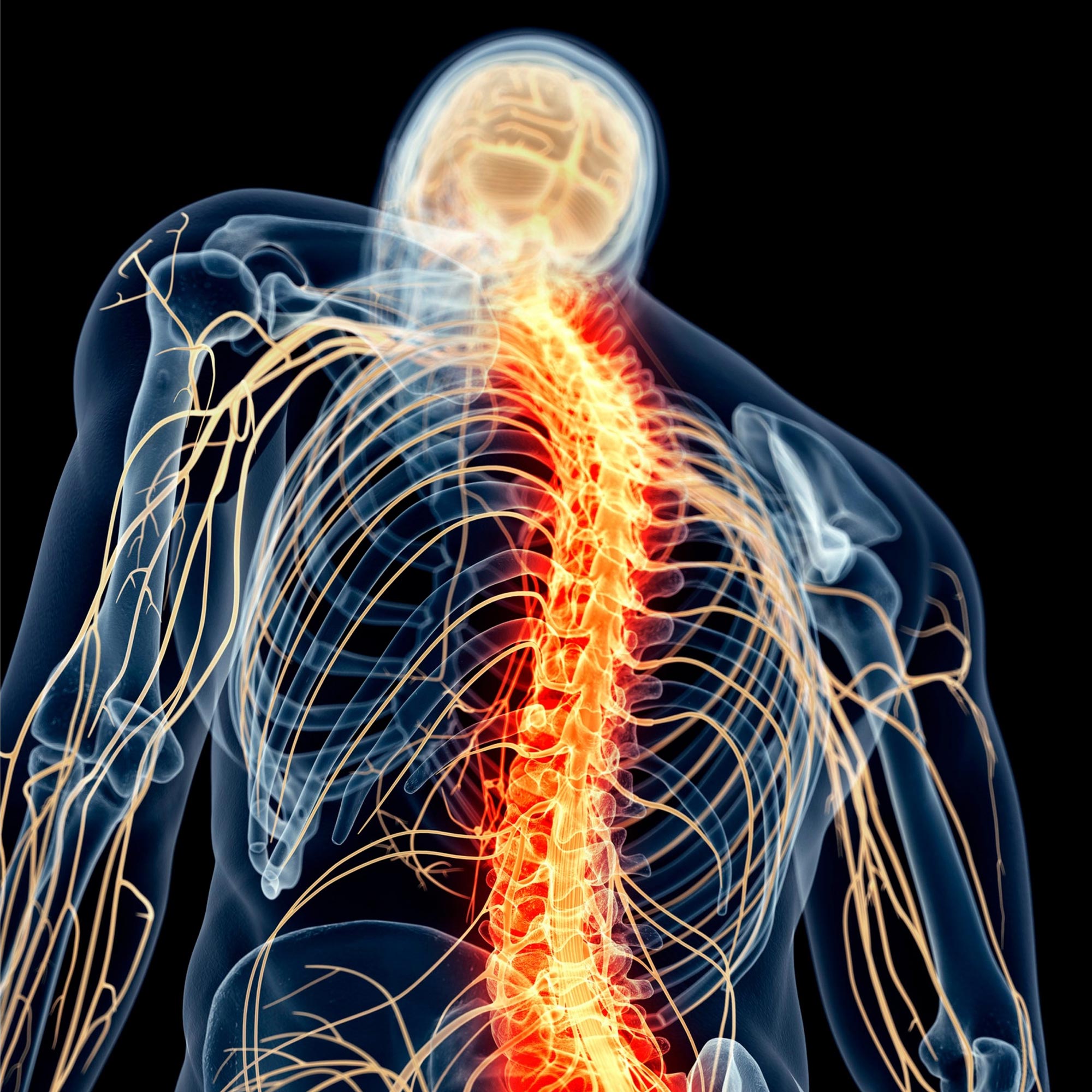 Spinal-Cord-Nerve-Pain.jpg