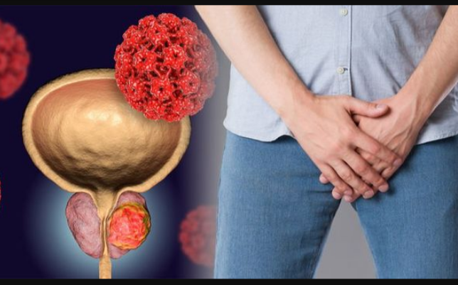 Enlarged-prostate-Three-signs-of-the-condition-and-when-it-could-be-cancer-1151124-jpg-590×350-.png